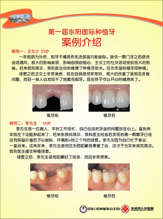 美国专家免费植牙开始报名